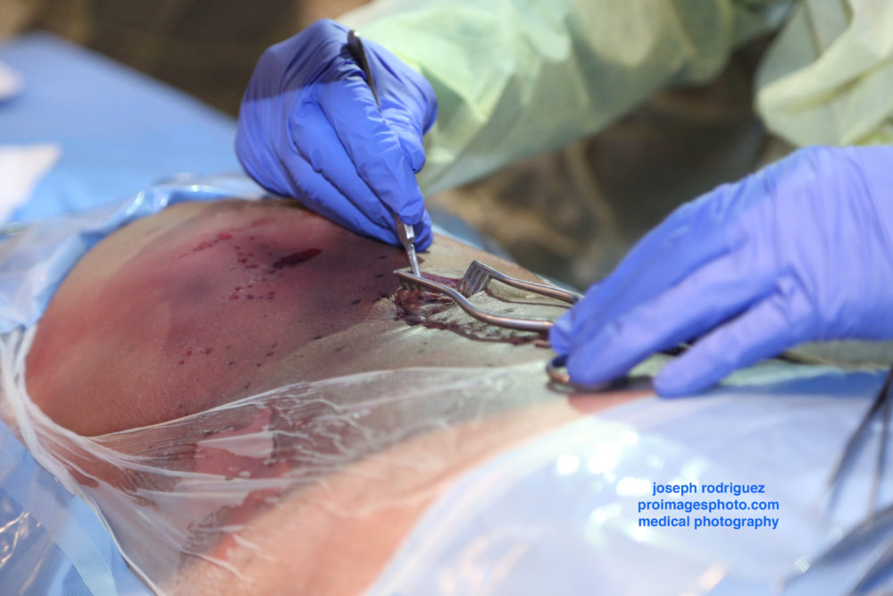 Healthcare and Medical Photography of of Practice Hands-On Skills in Procedural Cadaver Lab
